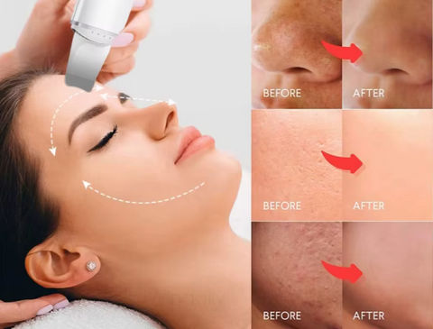 Espátula Facial Ultrasónica - La Droguería